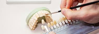 Materials Used in Dental Labs: A Comprehensive Guide